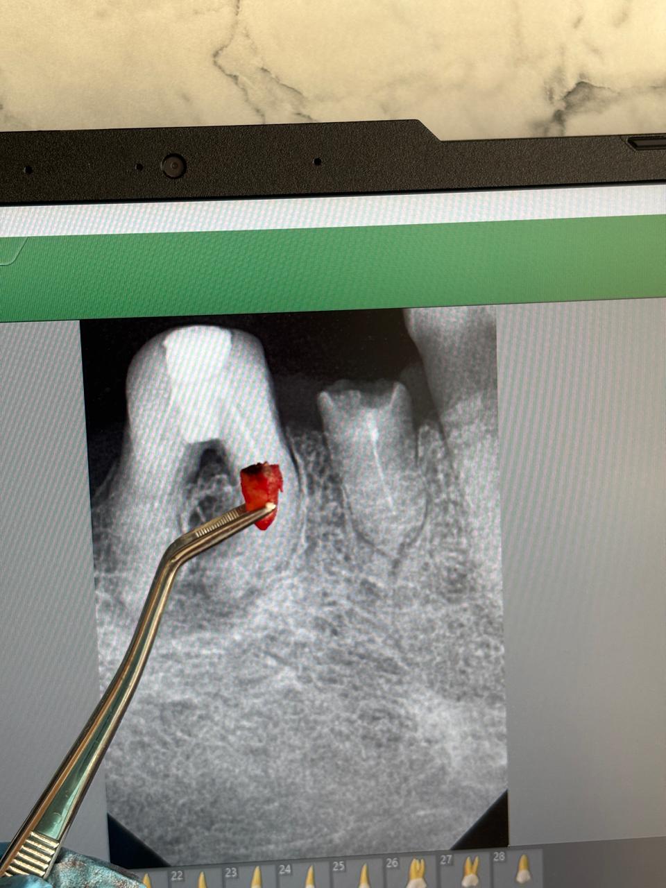 Radiographie dentaire
